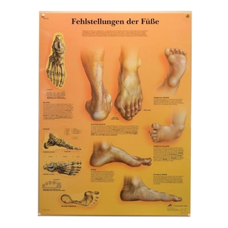 Plansje Feilstilling f&#248;tter 50x68cm