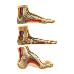 Modellf&#248;tter normal 3stk