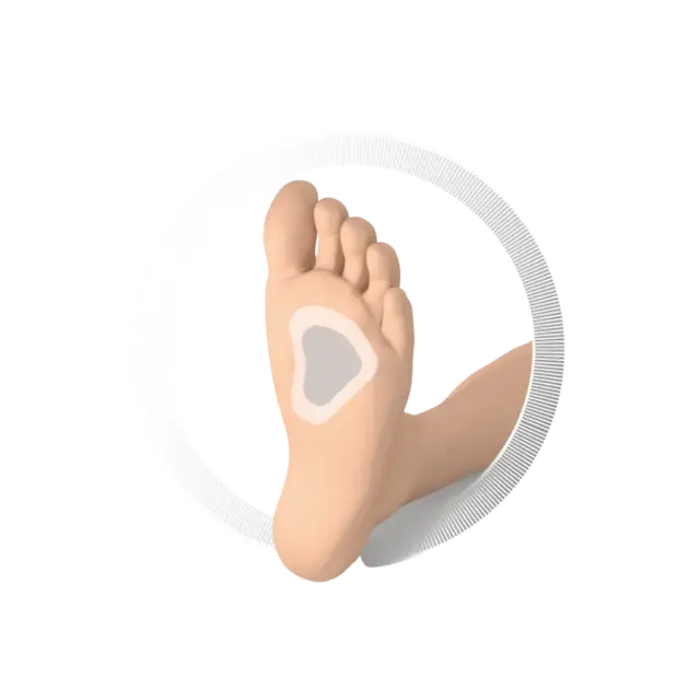 Ruck Pelotter T-form M 